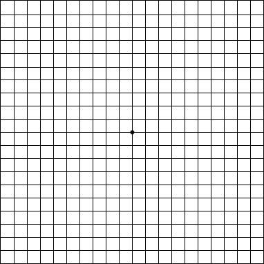 amsler-grid